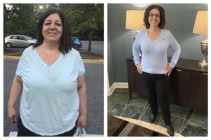 Safe, Effective Surgical Weight-Loss Services With Gastric Sleeve Specialist in Texa